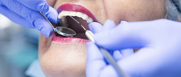 Best Dentist for Tooth Abscess  in Maple Heights, OH